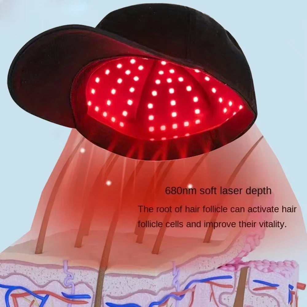 96 Lamp LED Laser Beads Therapy Cap Promoting Hair Growth - Big Ass Store