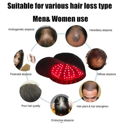 96 Lamp LED Laser Beads Therapy Cap Promoting Hair Growth - Big Ass Store