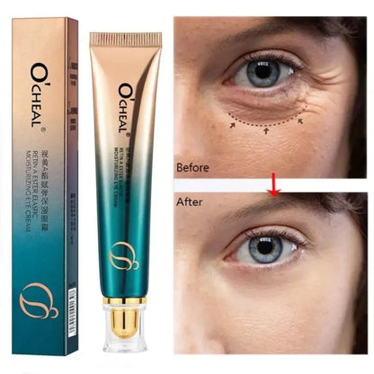 New Anti-Wrinkle Eye Cream--Watch Your Eyes Brighten! - Big Ass Store